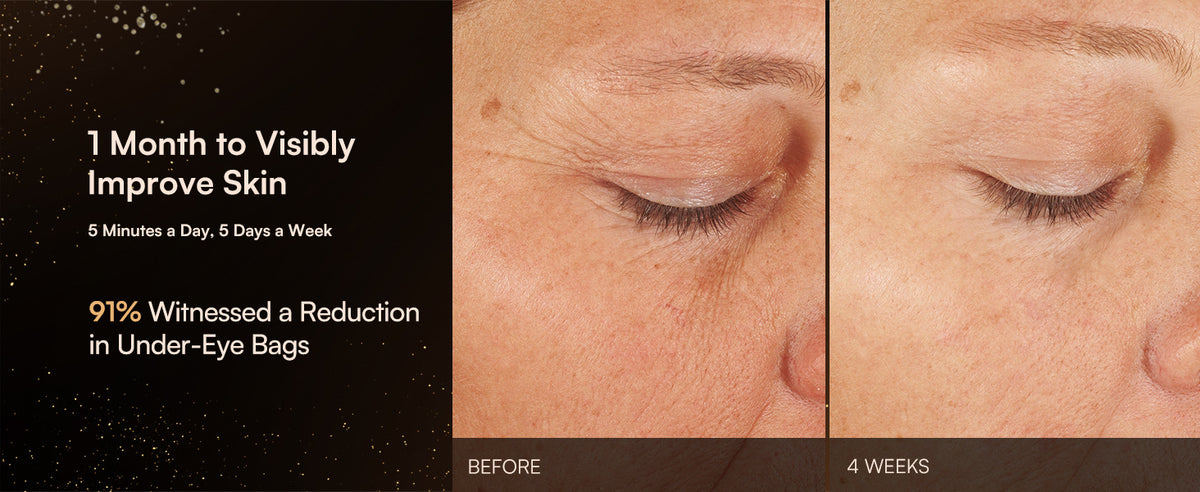 3-in-1 Microcurrent Facial Beauty Device