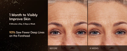 3-in-1 Microcurrent Facial Beauty Device