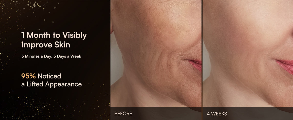3-in-1 Microcurrent Facial Beauty Device
